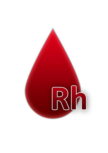 Factors to Consider When Buying an Old Rolex Submariner